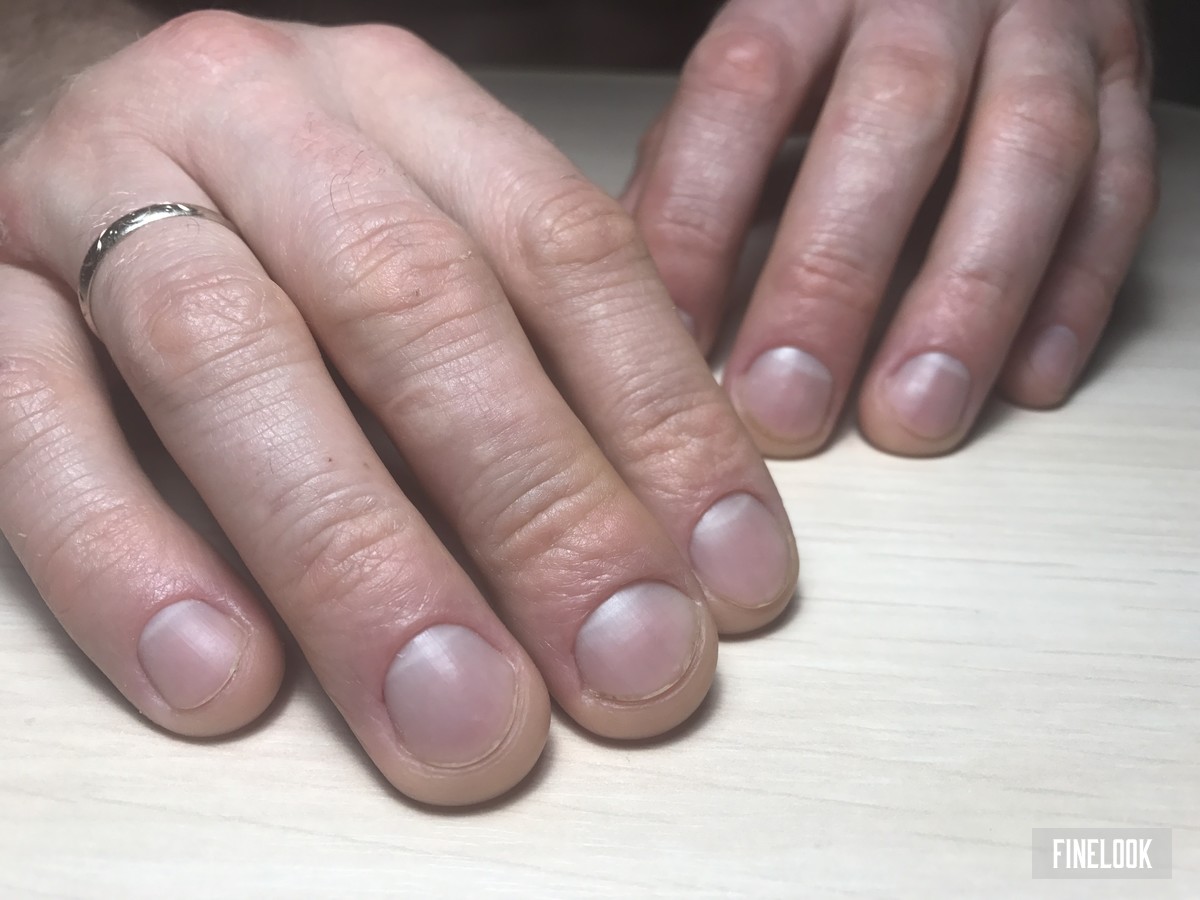 Мужские ногти не красывые