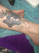 Удаление татуировок от мастера Ситченко Натали. Фото #29408