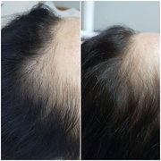 Лечение волос от мастера Кушнир Виктория. Фото #31821