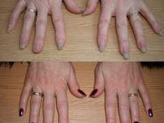 Коррекция нарощенных ногтей от мастера Ровная Любовь. Фото #fl/19852